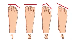 Persoonlijkheidstest: wat zegt jouw voetvorm echt over je karakter?